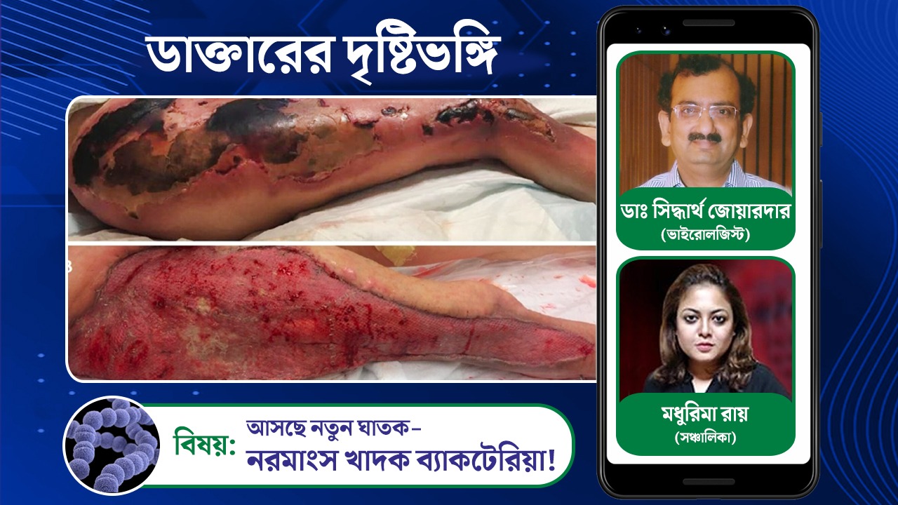 ব্যাকটিরিয়ার খাদ্য নরমাংস? সচেতন তো আপনি? আলোচনায় বিশিষ্ট চিকিৎসক ডাঃ সিদ্ধার্থ জোয়ারদার