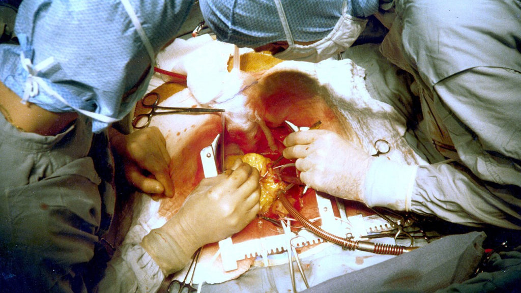 বাংলার সরকারি স্বাস্থ্যক্ষেত্রে চালু হল ৬ বছরের কার্ডিওভাসকুলার সার্জারি পাঠ্যক্রম