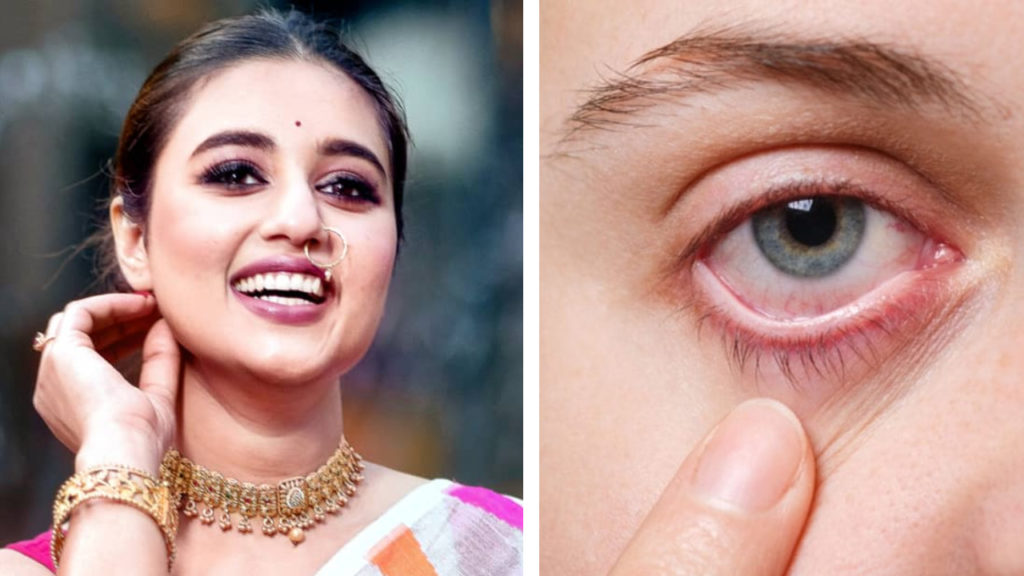 চোখে অসহ্য যন্ত্রণা!! কী হল স্বস্তিকার?