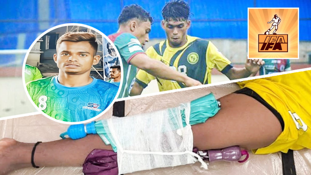 তারকের চোটের ছবি ভাইরাল – IFA-র বিরুদ্ধে ক্ষোভে ফুঁসছেন ক্রীড়াপ্রেমীরা