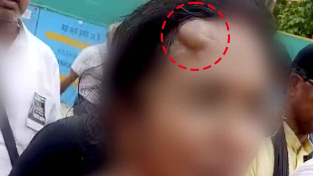 RG Kar Protest: নবান্ন অভিযানে জখম নির্যাতিতার মা, শুভেন্দুকে দায়ী করল অভয়া মঞ্চ