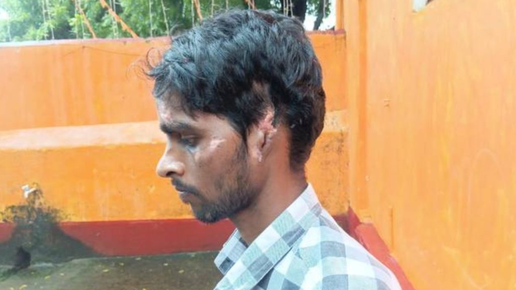BJP শাসিত মহারাষ্ট্রে বাঙালি শ্রমিকের উপর নৃশংস হামলা, কেটে নেওয়া হল দুই কান