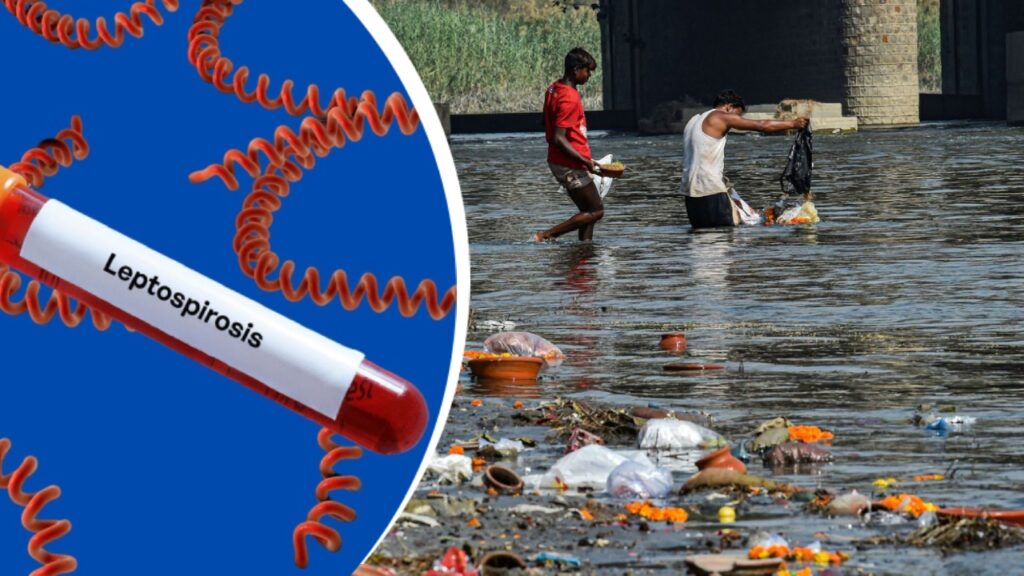 নোংরা জমা জল থেকে ছড়াতে পারে লেপ্টোস্পাইরোসিস! সতর্ক থাকবেন কী ভাবে?