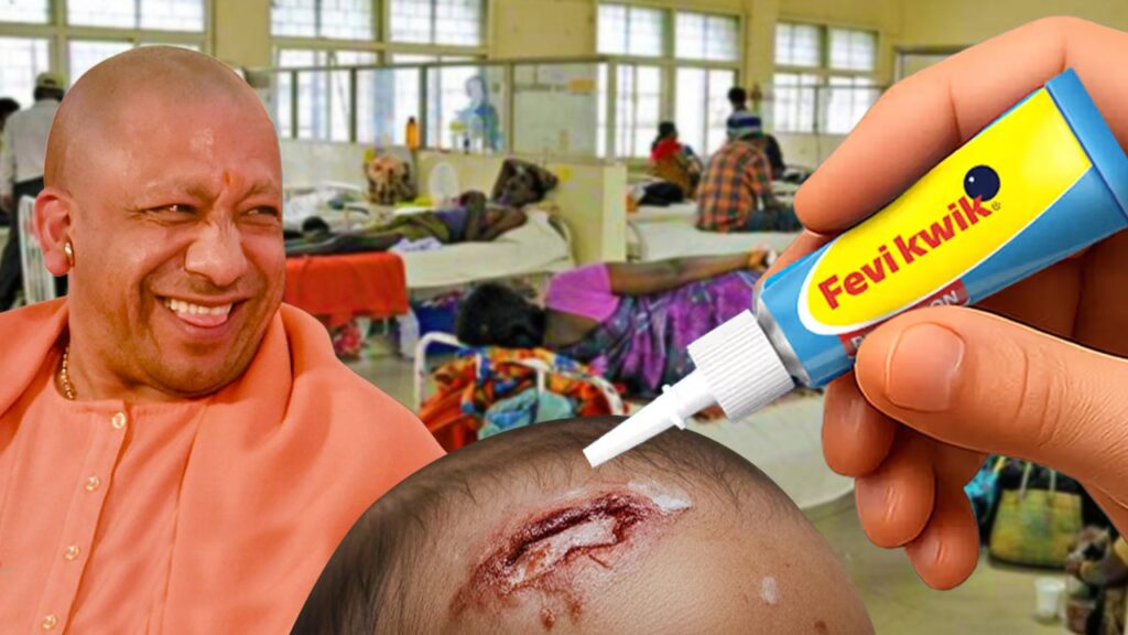 স্বাস্থ্যক্ষেত্রে ভয়ঙ্কর ছবি যোগীরাজ্যে, সেলাই নয় শিশুর ক্ষতে পড়ল ফেভিকুইক